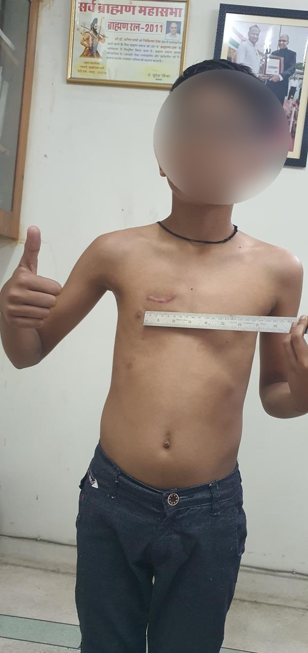 World Record — Smallest Incision in Open-Heart Surgery