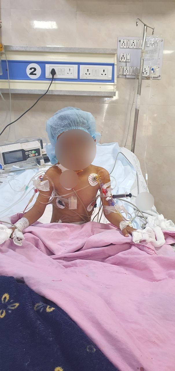 ASD - Atrial Septal Defect surgical photo