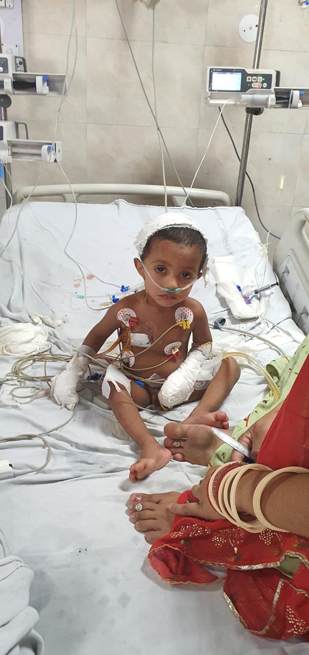 ASD - Atrial Septal Defect surgical photo