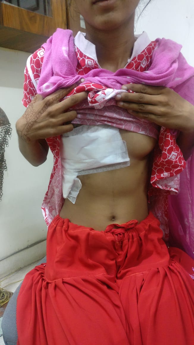 AV Canal Defect surgical photo