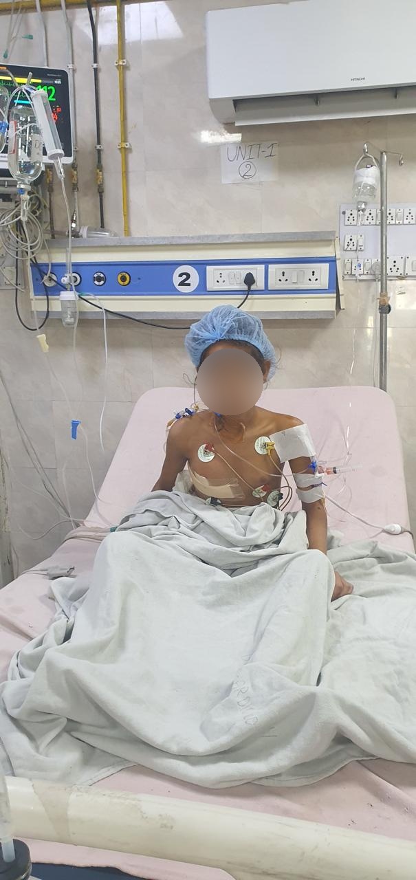 AV Canal Defect surgical photo