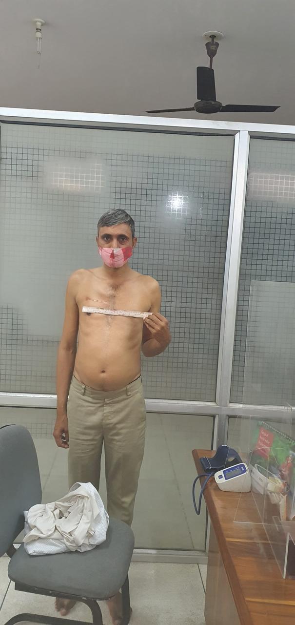 AVR - Aortic Valve Replacement surgical photo