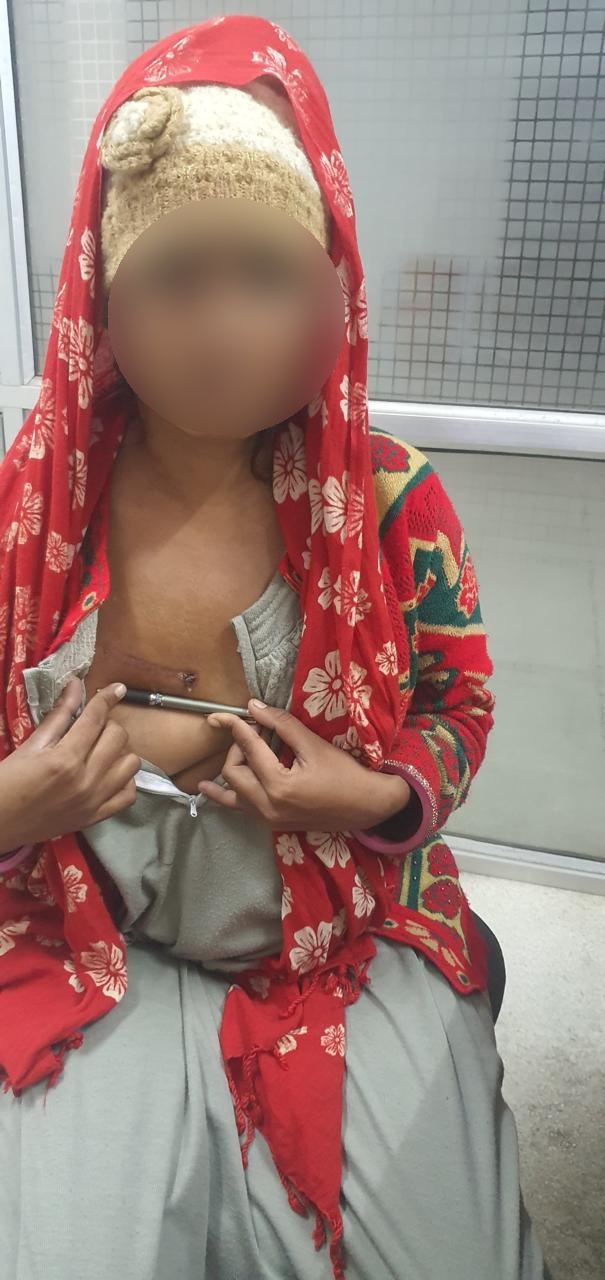 AVR - Aortic Valve Replacement surgical photo