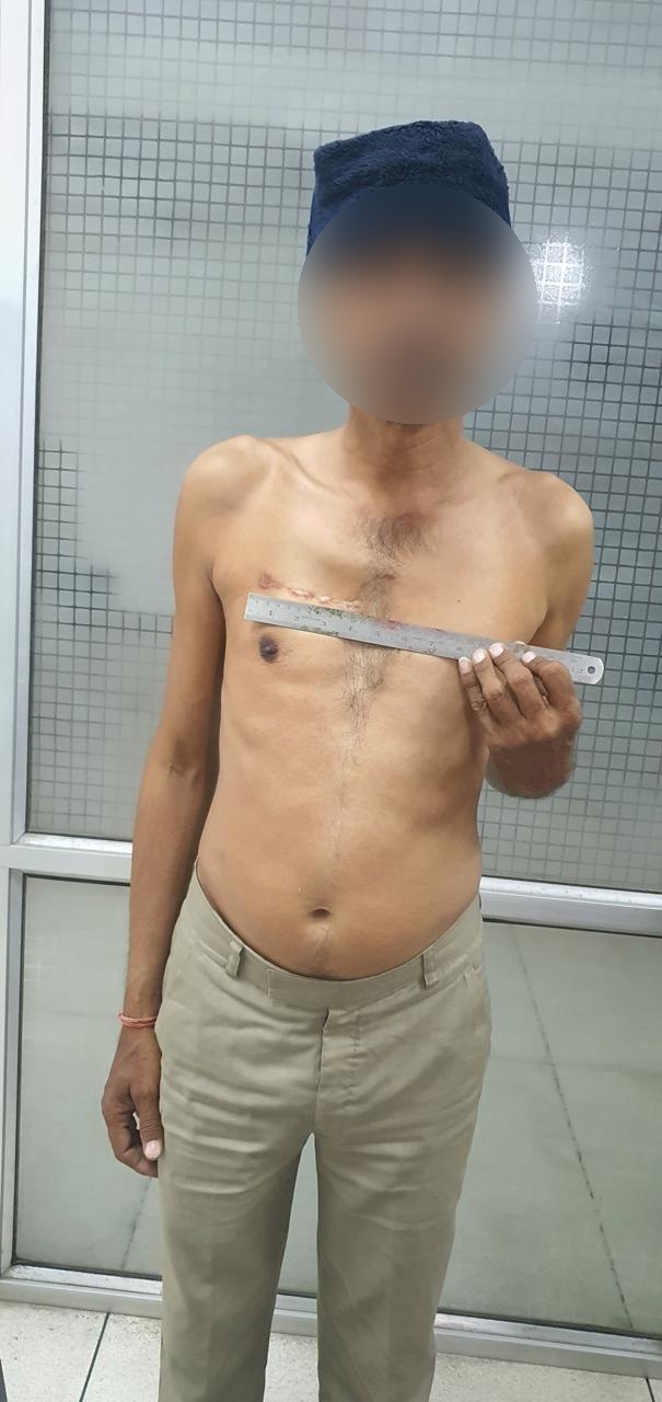 AVR - Aortic Valve Replacement surgical photo