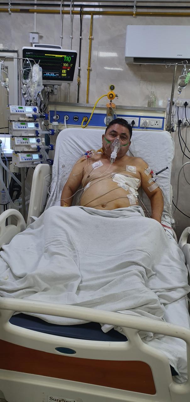 CABG - Coronary Artery Bypass surgical photo