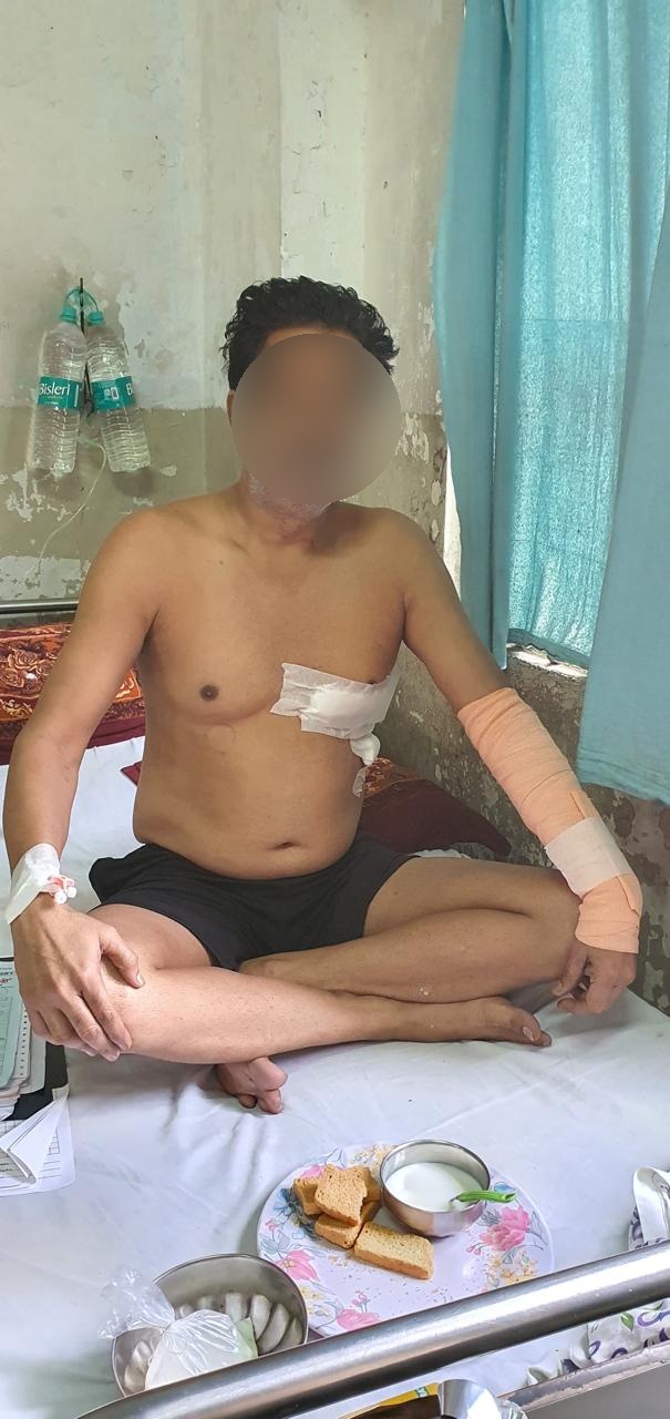 CABG - Coronary Artery Bypass surgical photo