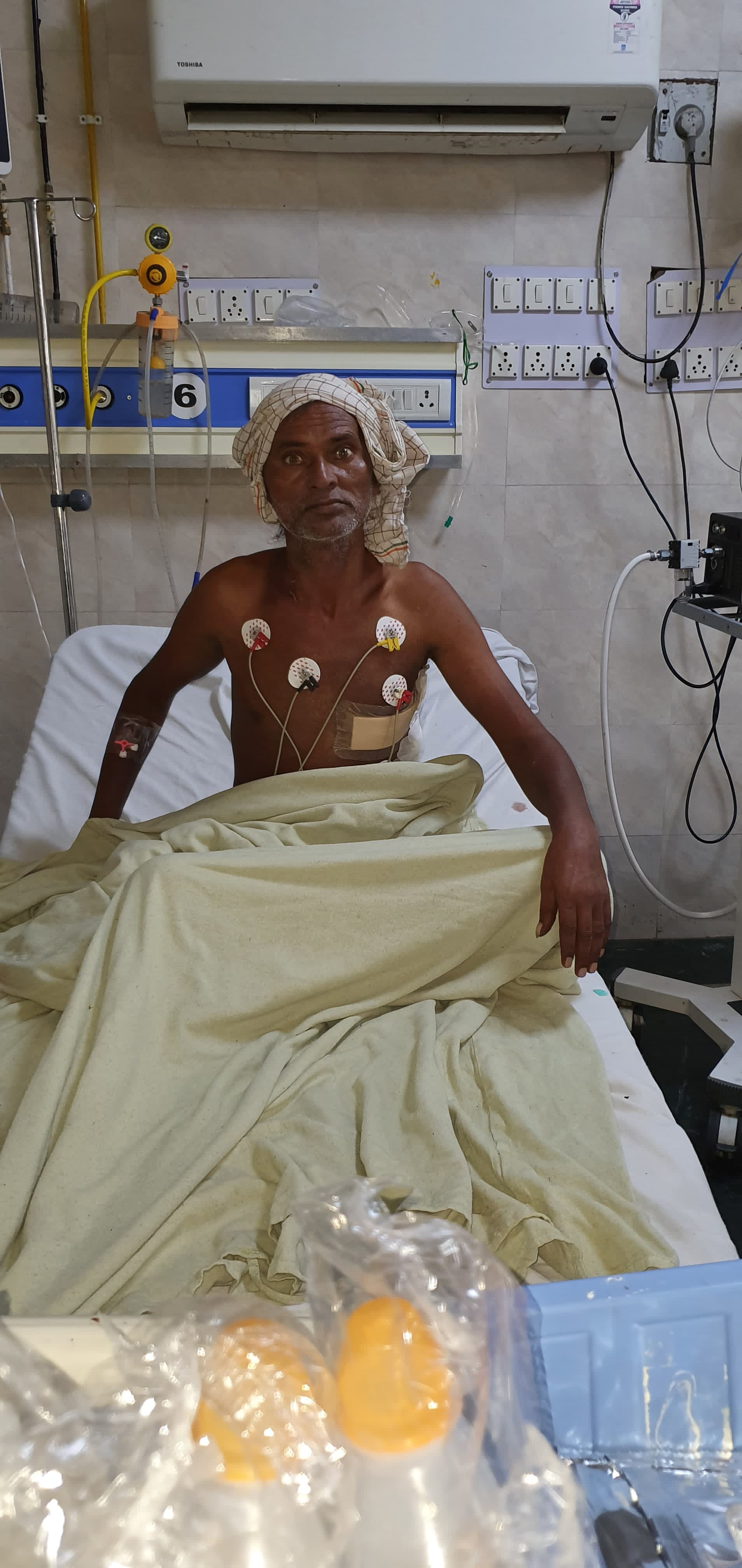 CABG - Coronary Artery Bypass surgical photo