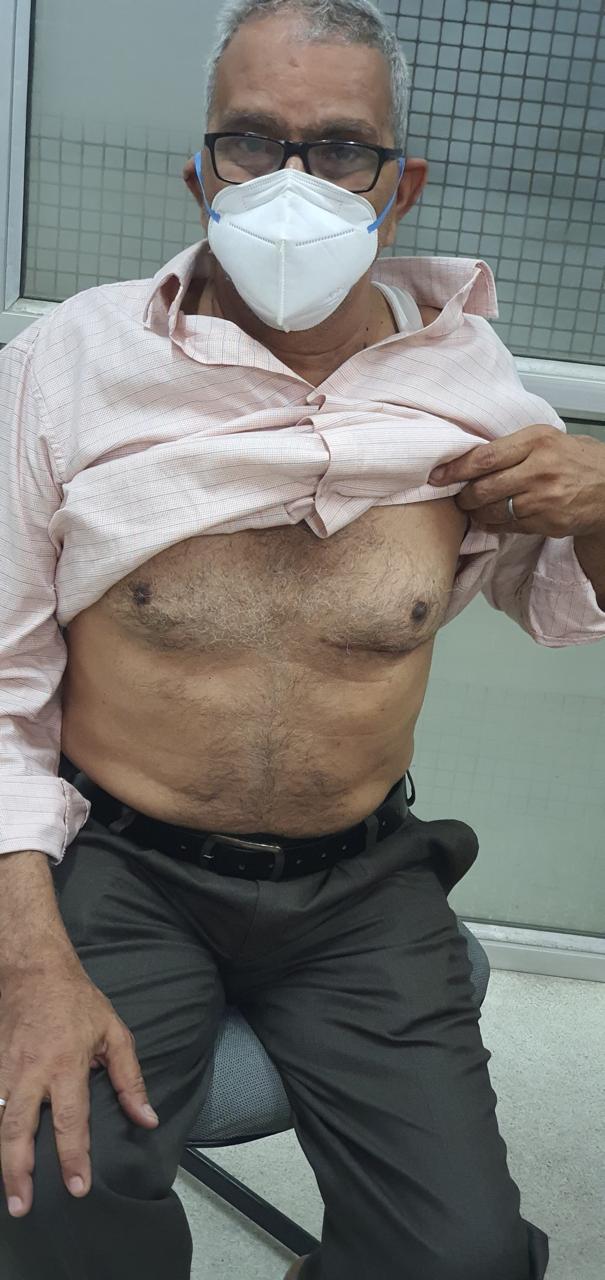 CABG - Coronary Artery Bypass surgical photo