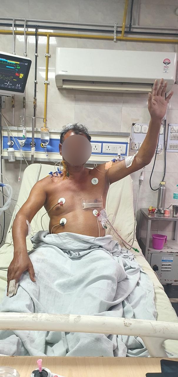 CABG - Coronary Artery Bypass surgical photo