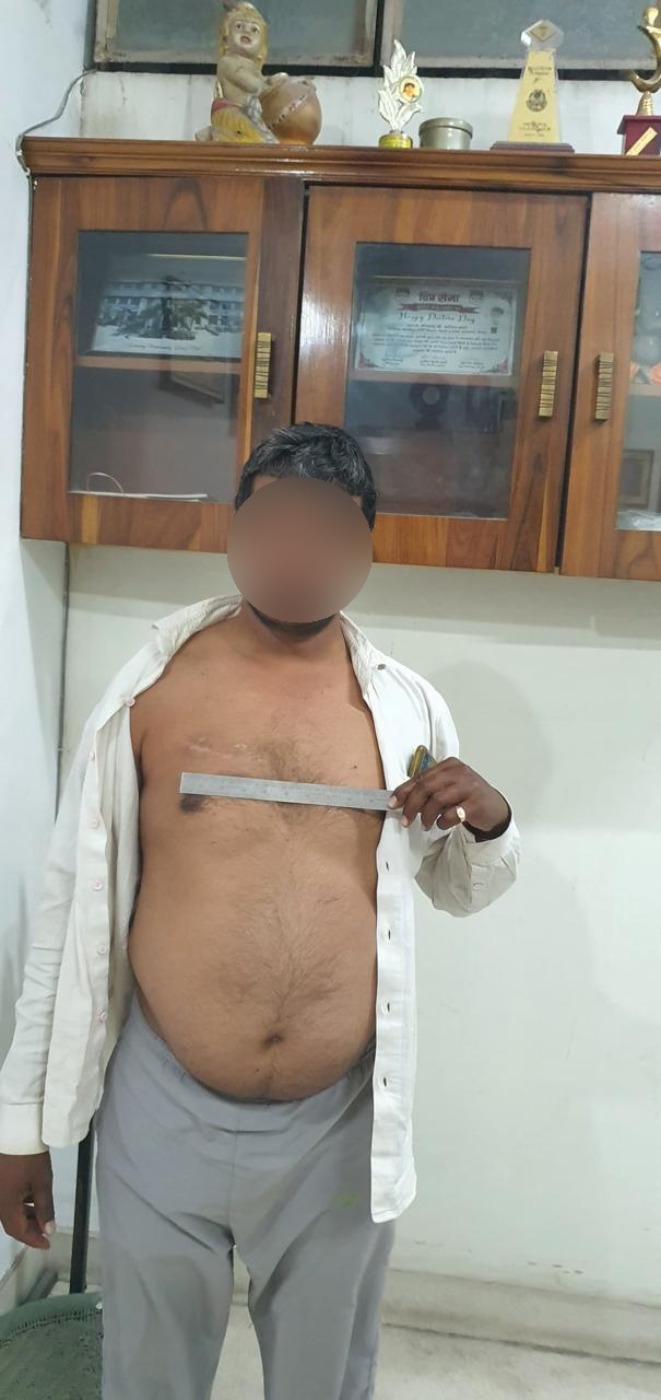 DVR - Double Valve Replacement surgical photo