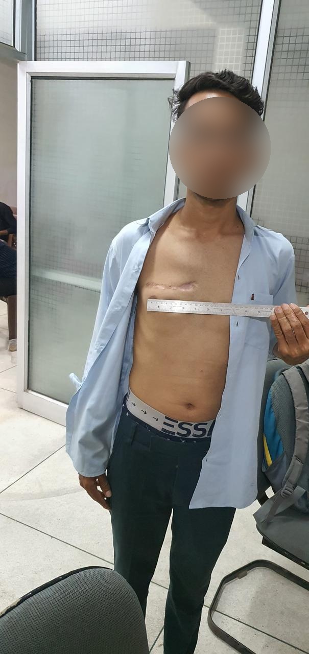 DVR - Double Valve Replacement surgical photo