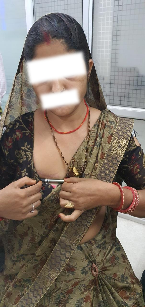 DVR - Double Valve Replacement surgical photo