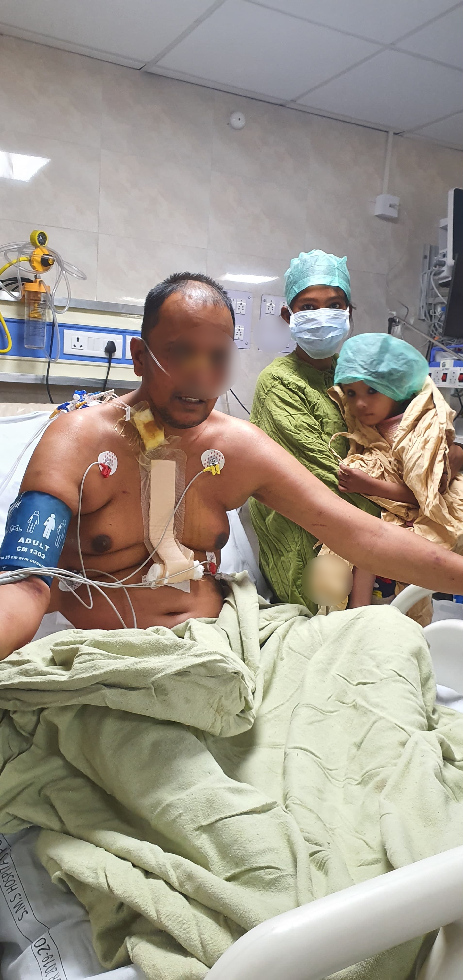 Heart Transplant surgical photo