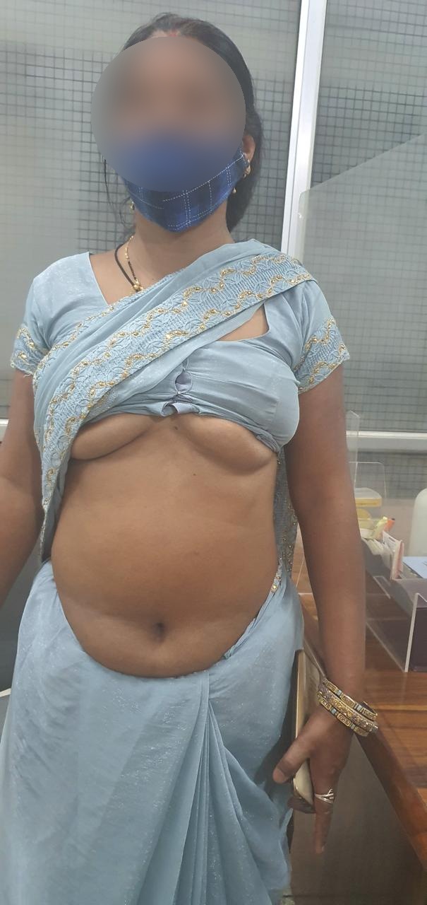 MVR - Mitral Valve Replacement surgical photo