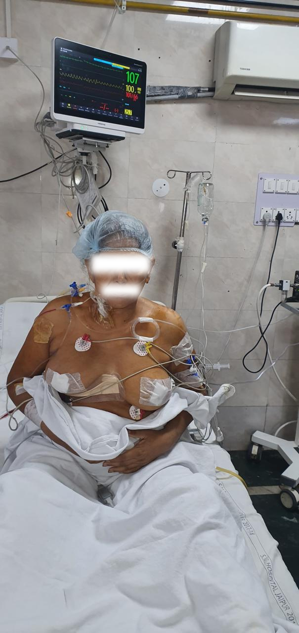 MVR - Mitral Valve Replacement surgical photo