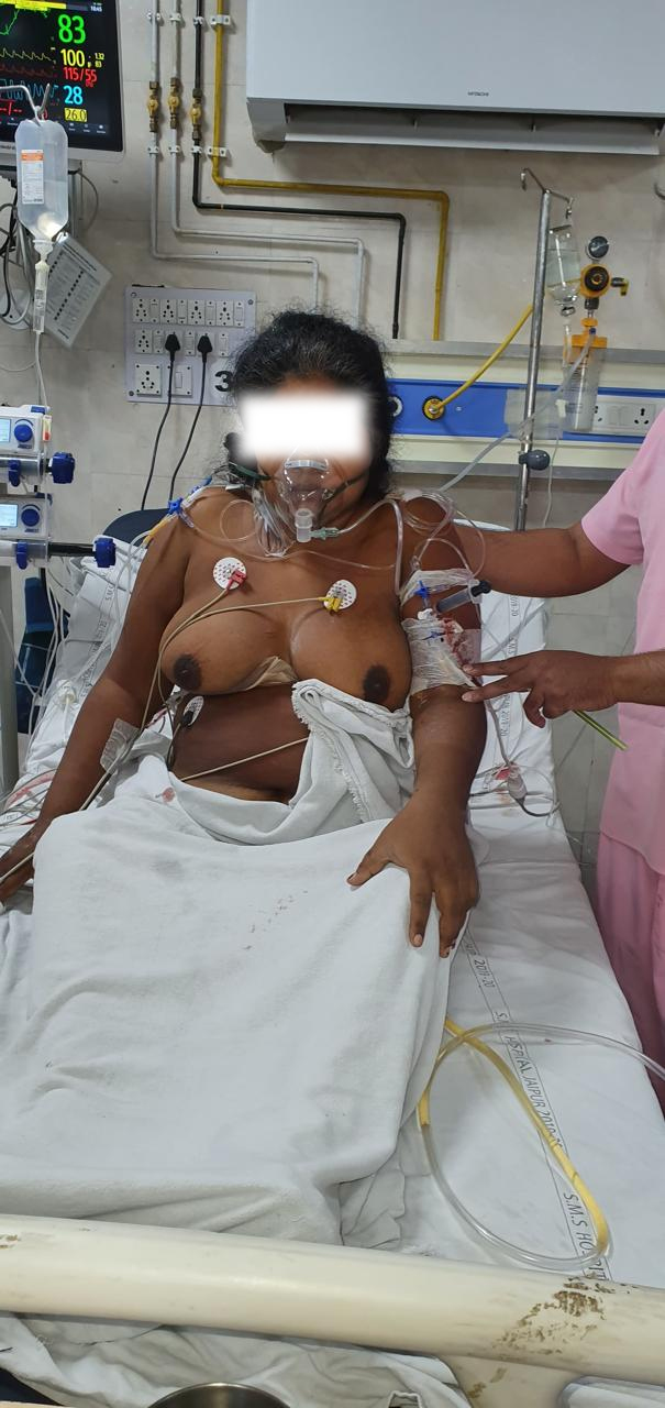 MVR - Mitral Valve Replacement surgical photo