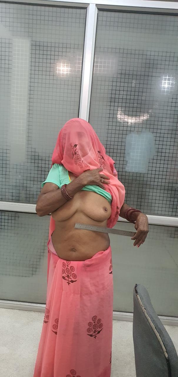 MVR - Mitral Valve Replacement surgical photo