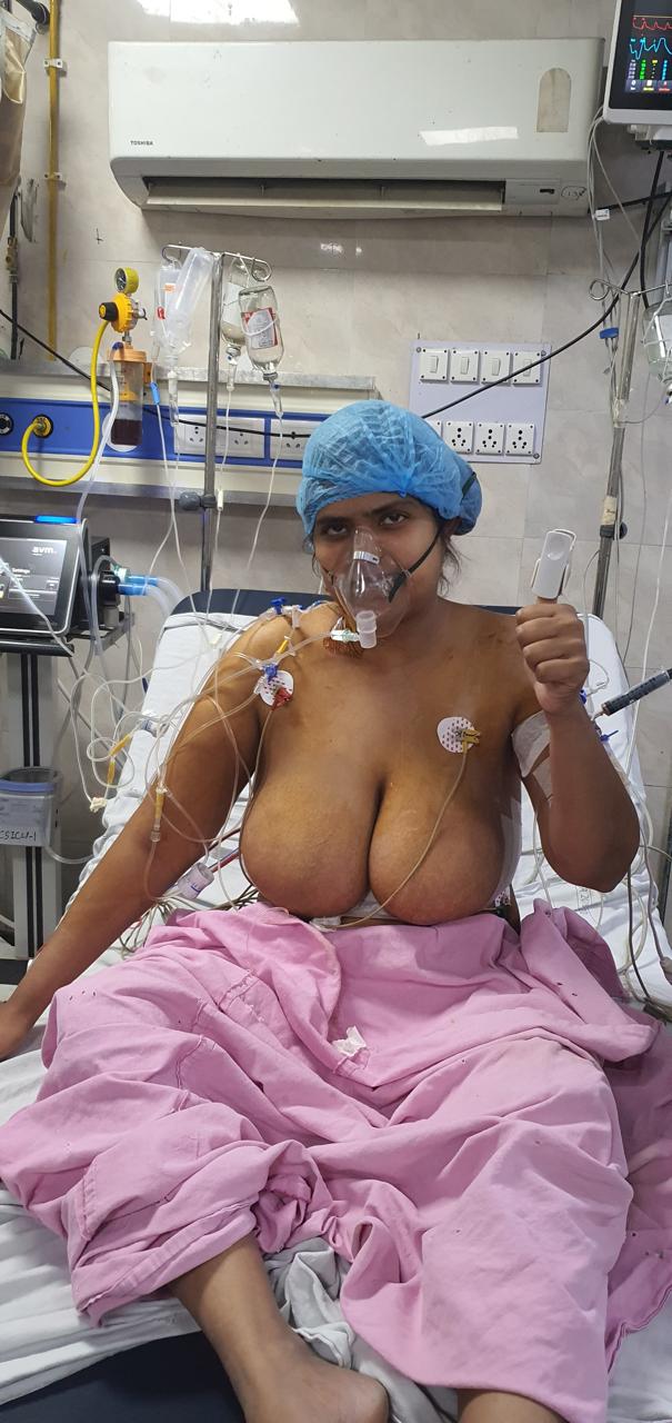 MVR - Mitral Valve Replacement surgical photo