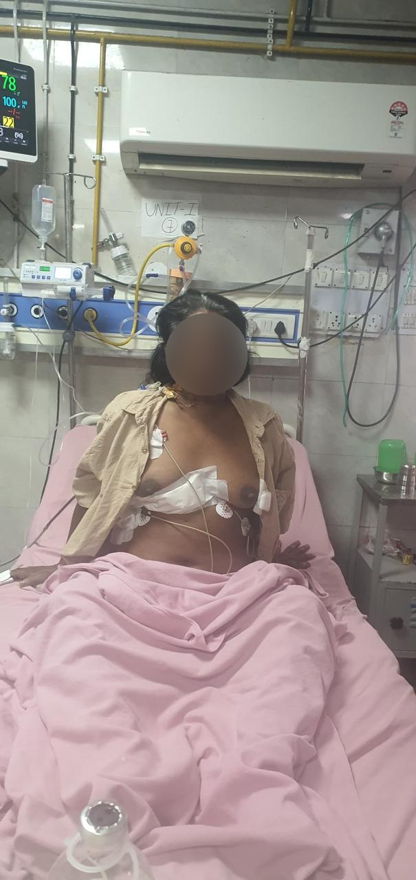 MVR - Mitral Valve Replacement surgical photo