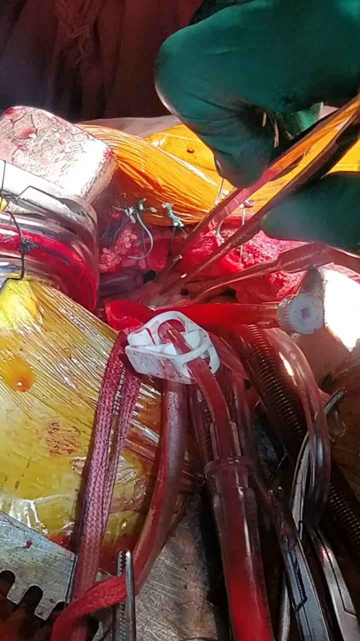 Unique Surgical Procedures surgical photo