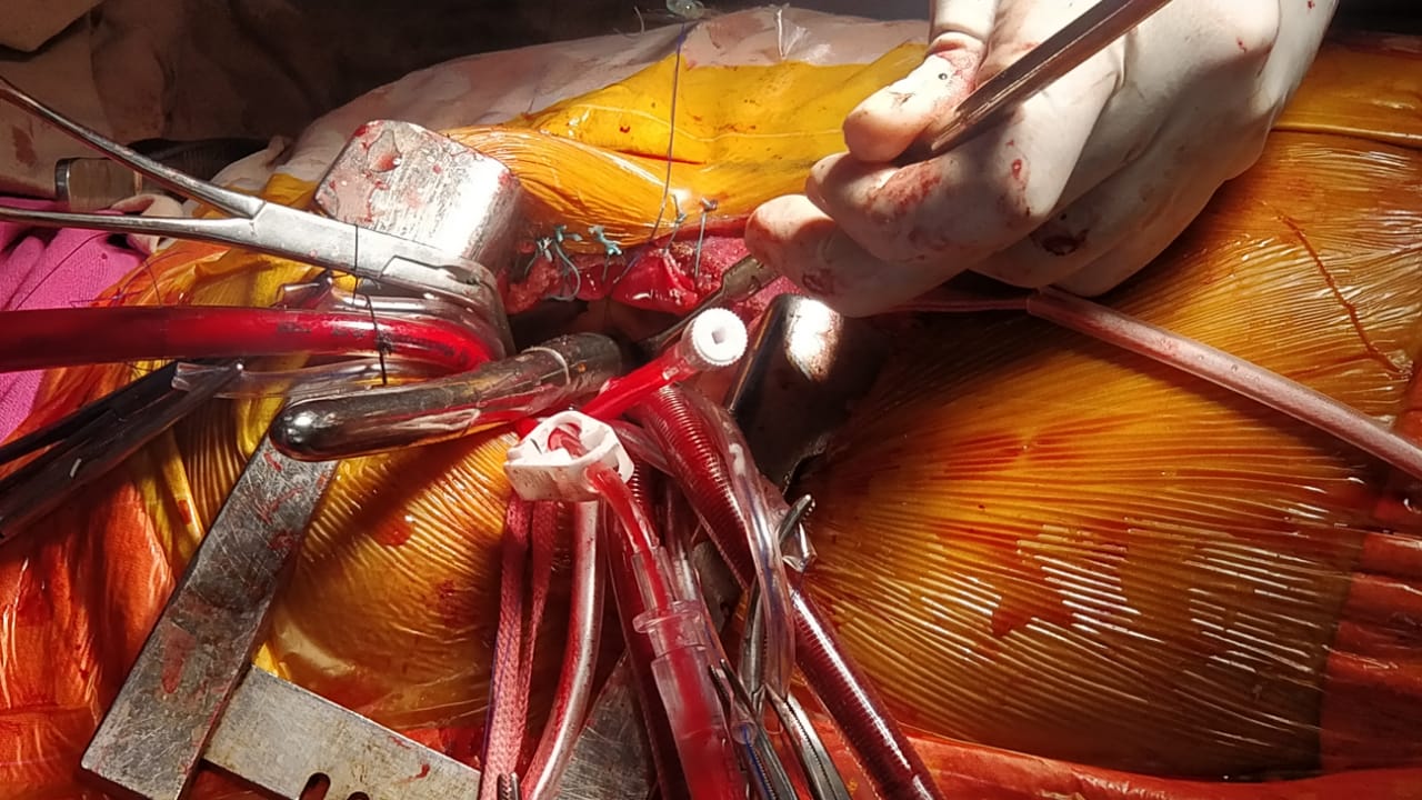 Unique Surgical Procedures surgical photo