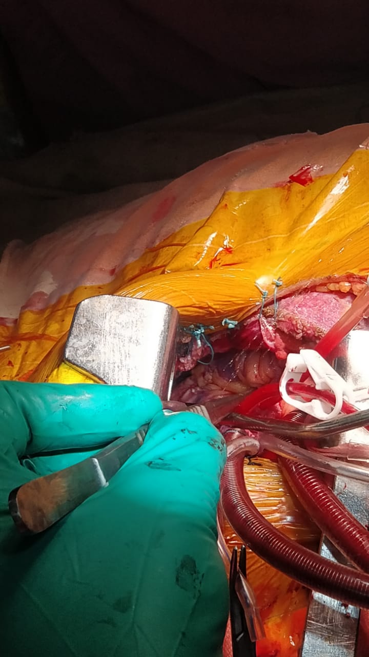 Unique Surgical Procedures surgical photo