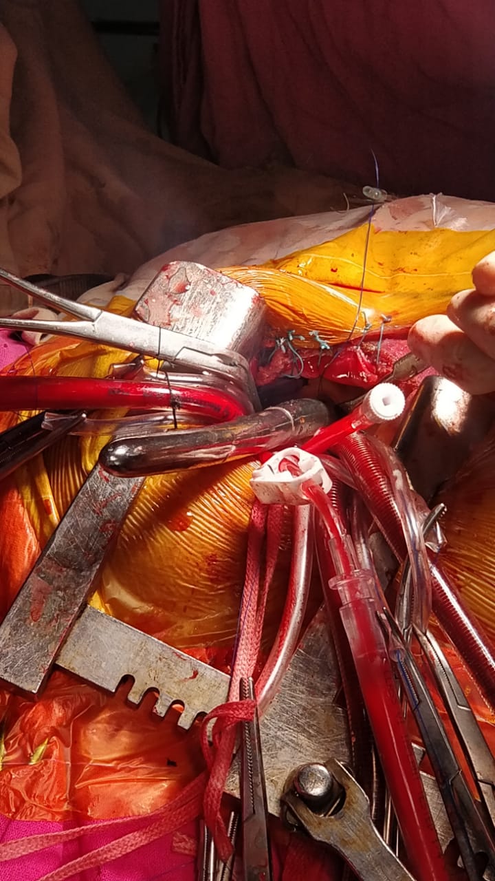 Unique Surgical Procedures surgical photo