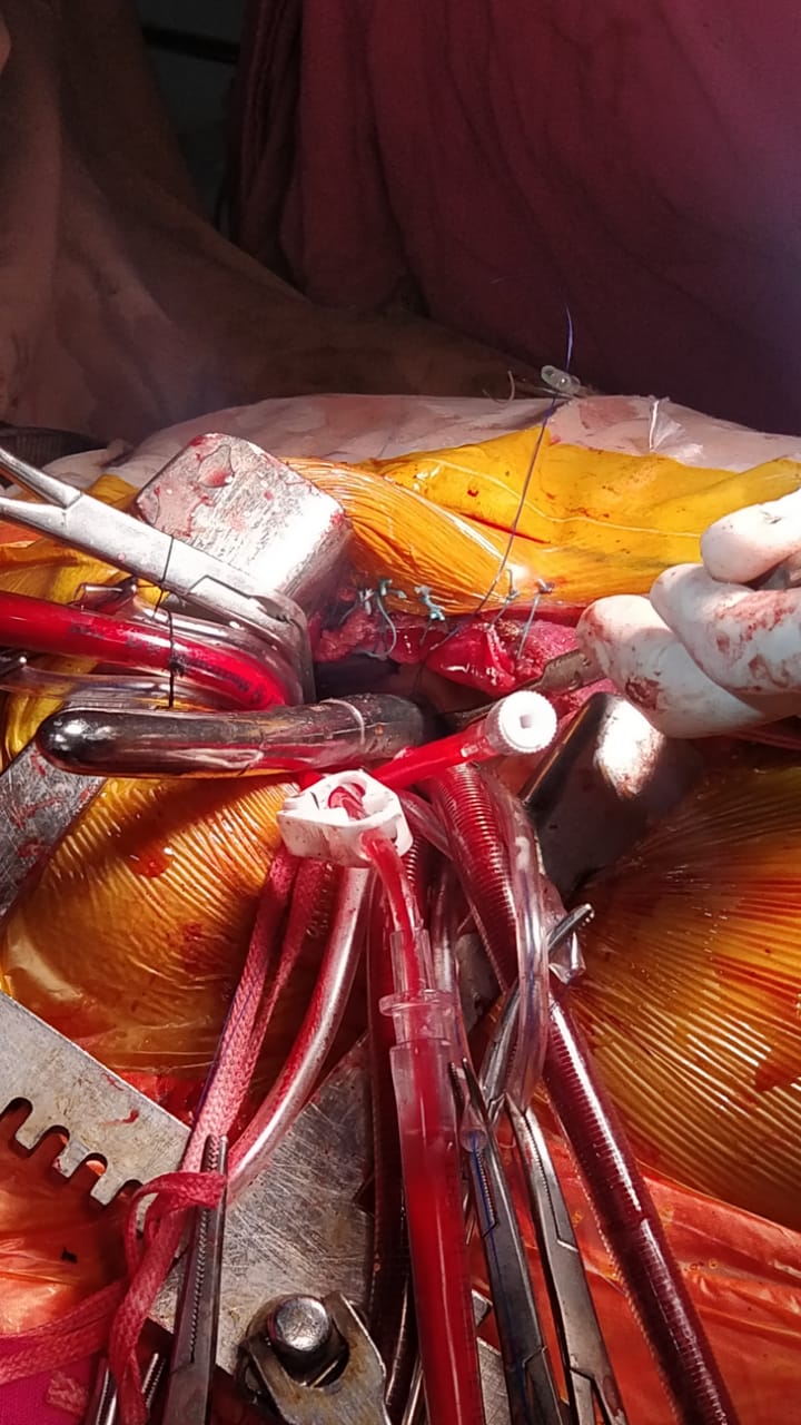 Unique Surgical Procedures surgical photo