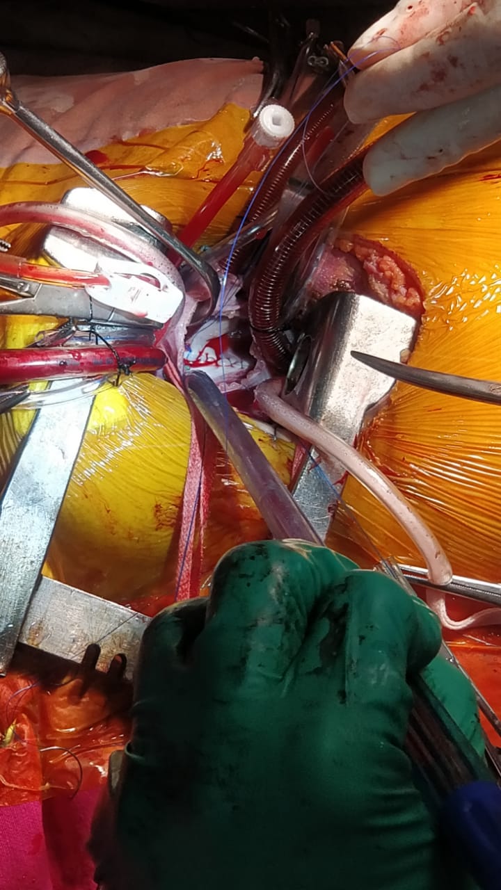 Unique Surgical Procedures surgical photo