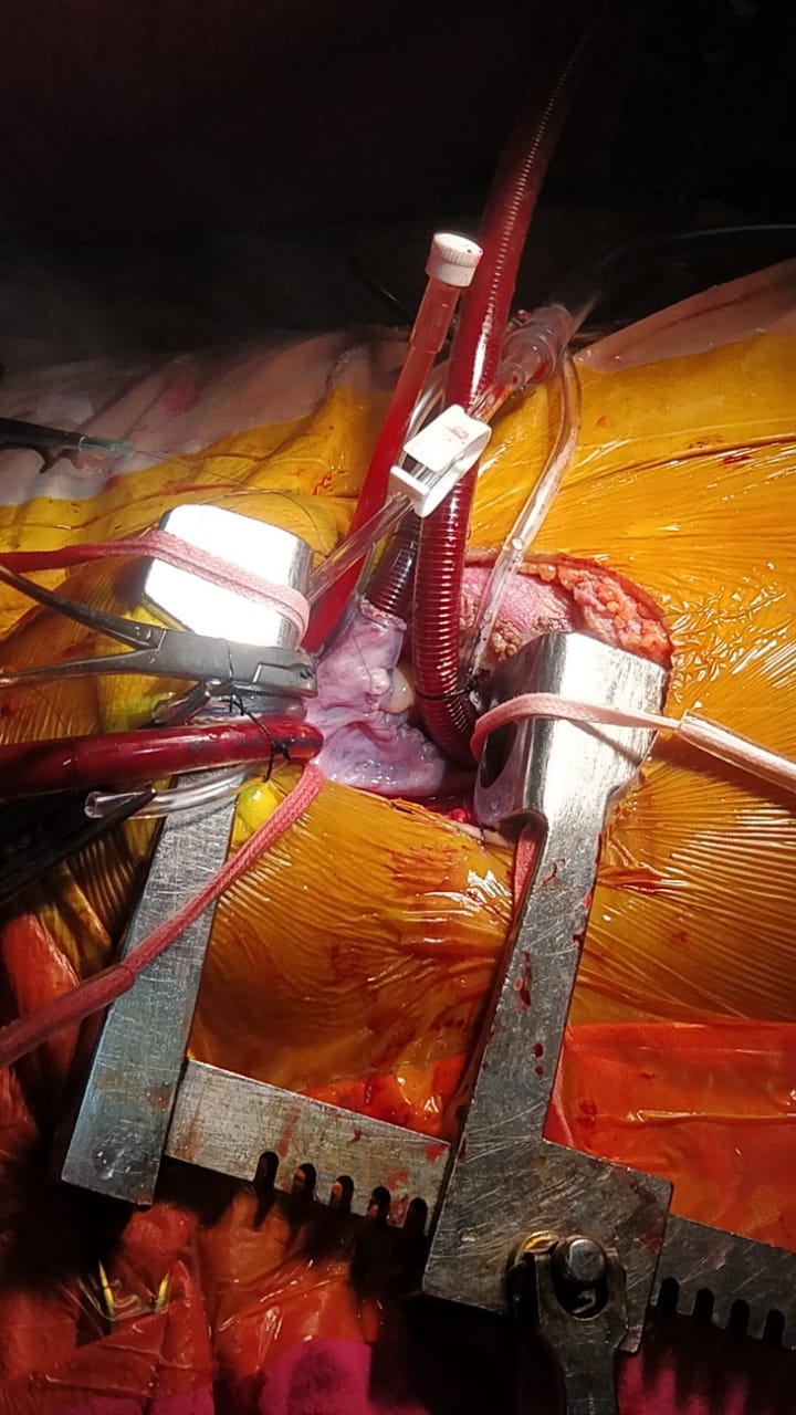 Unique Surgical Procedures surgical photo