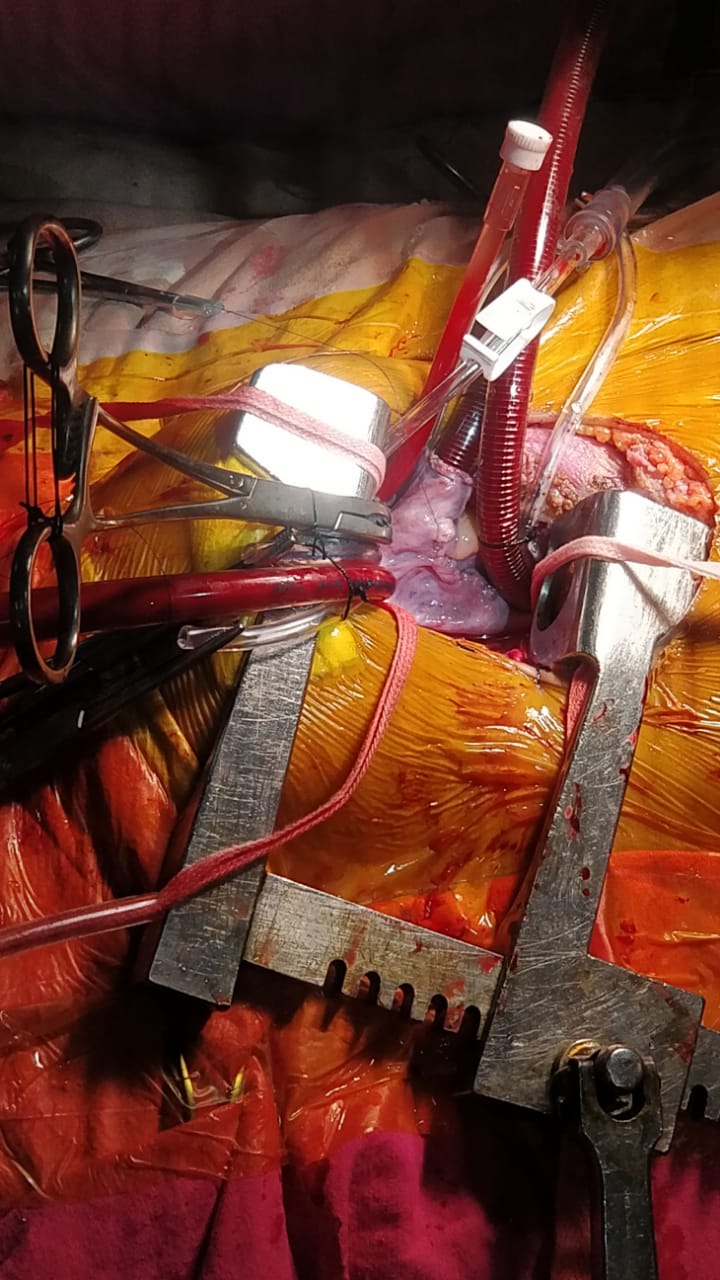 Unique Surgical Procedures surgical photo