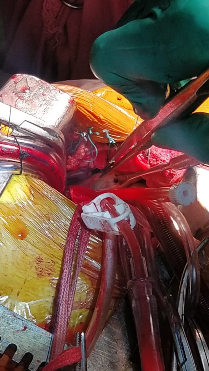 Unique Surgical Procedures surgical photo