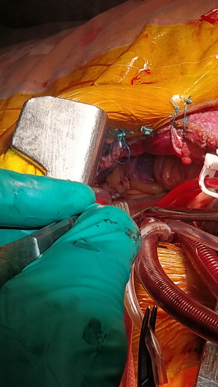 Unique Surgical Procedures surgical photo