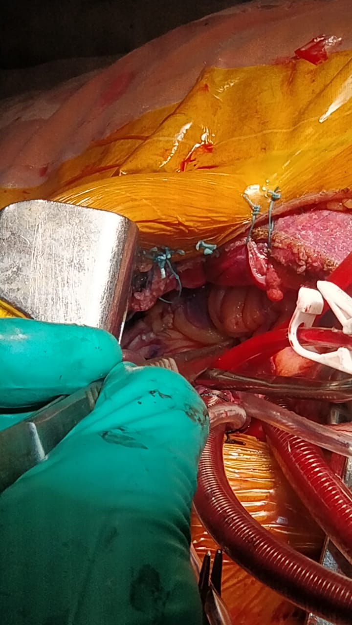 Unique Surgical Procedures surgical photo