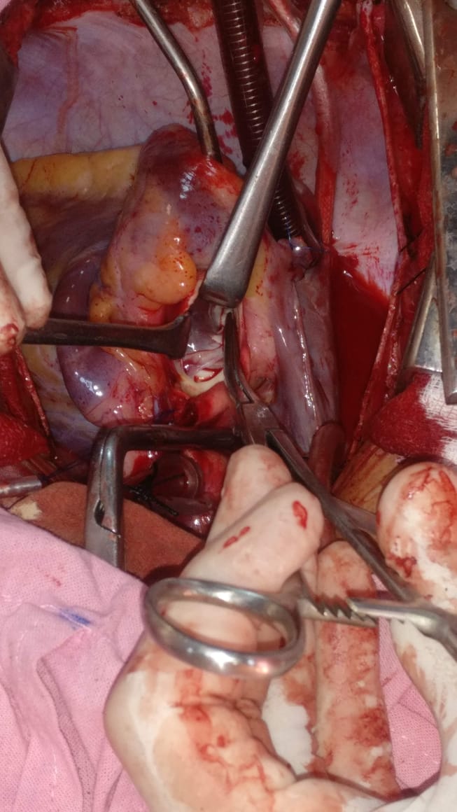 Unique Surgical Procedures surgical photo