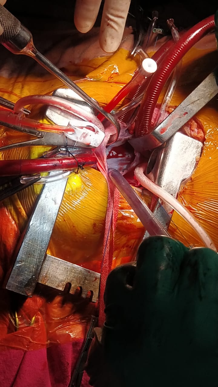 Unique Surgical Procedures surgical photo