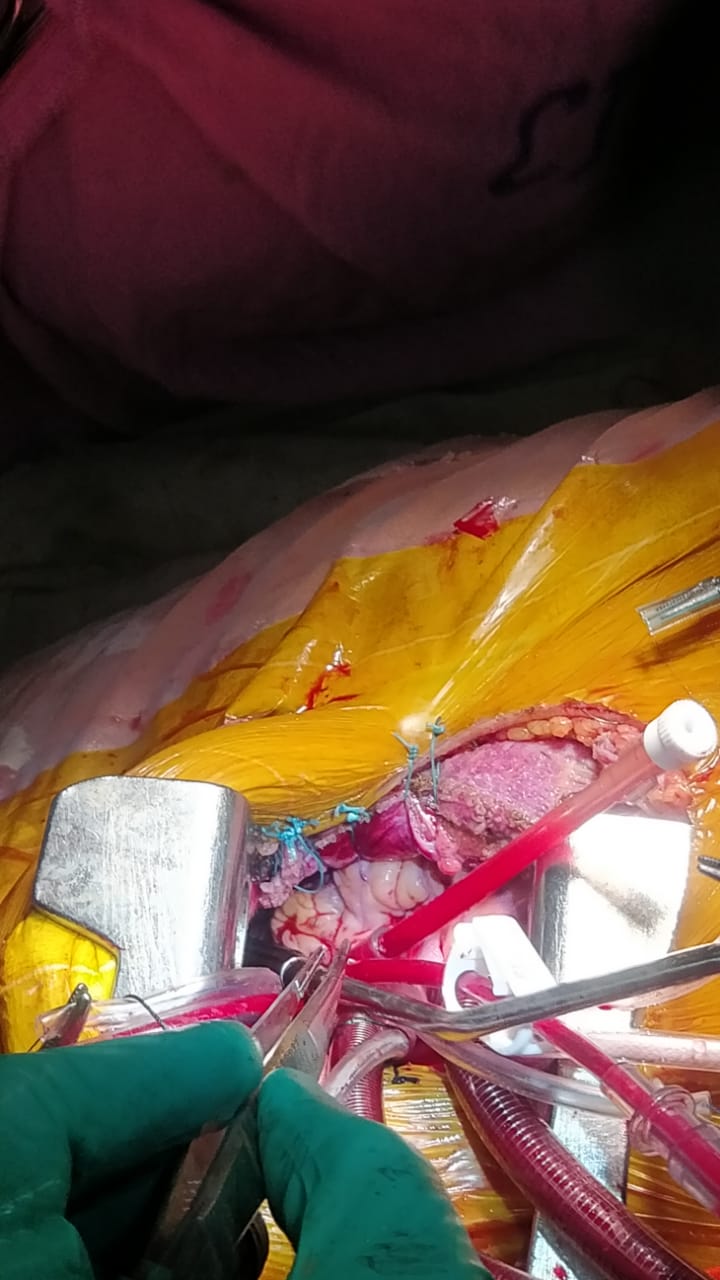 Unique Surgical Procedures surgical photo