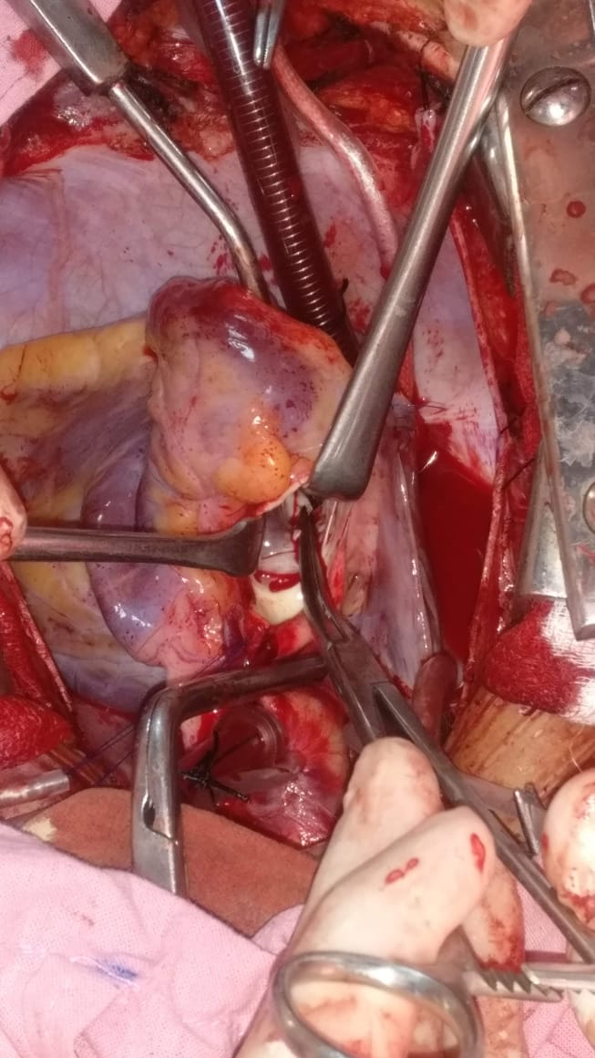 Unique Surgical Procedures surgical photo