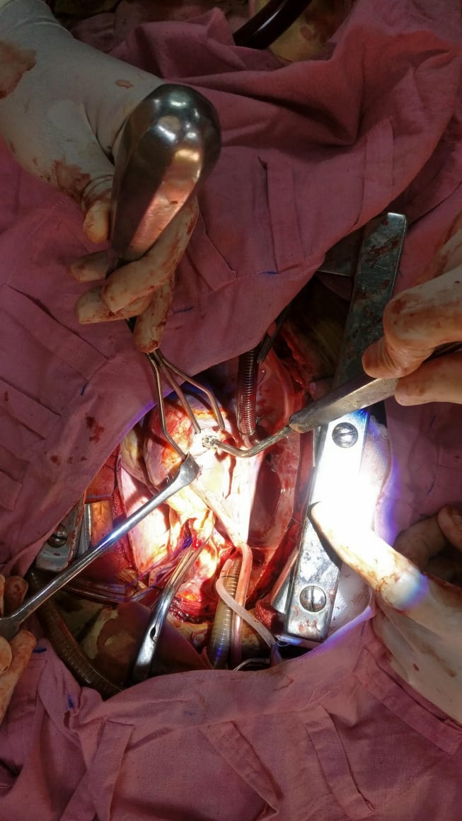 Unique Surgical Procedures surgical photo