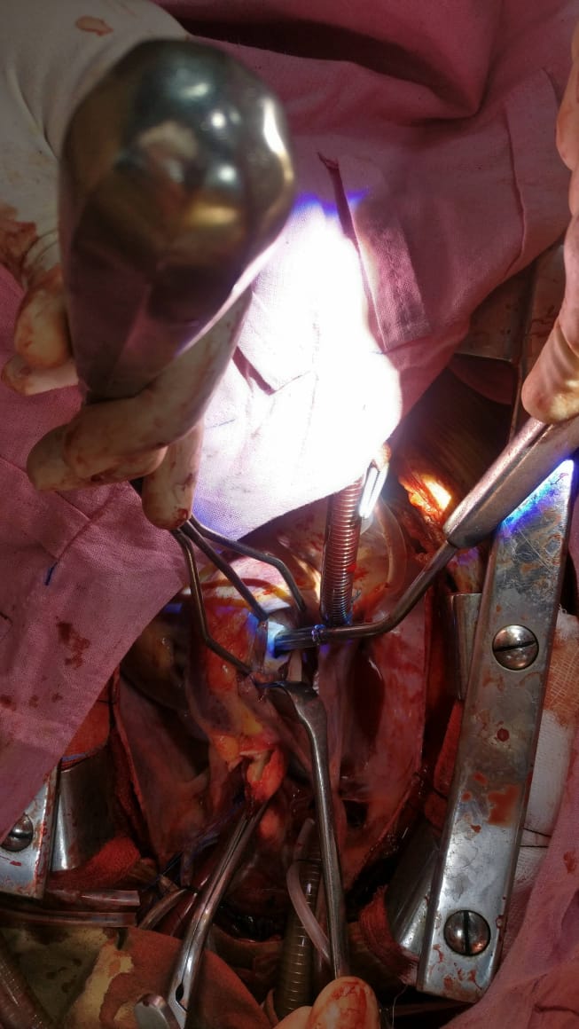 Unique Surgical Procedures surgical photo