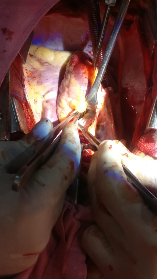 Unique Surgical Procedures surgical photo