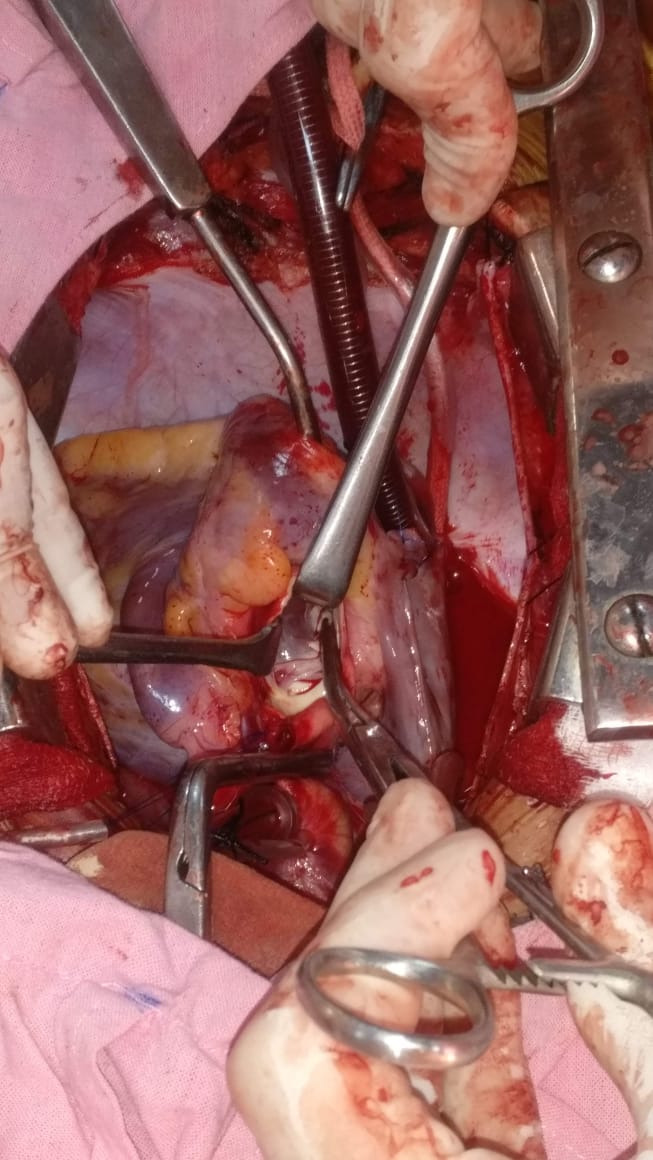 Unique Surgical Procedures surgical photo