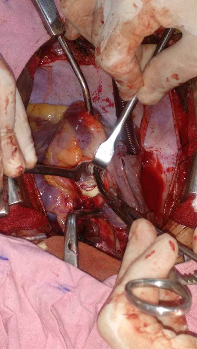 Unique Surgical Procedures surgical photo