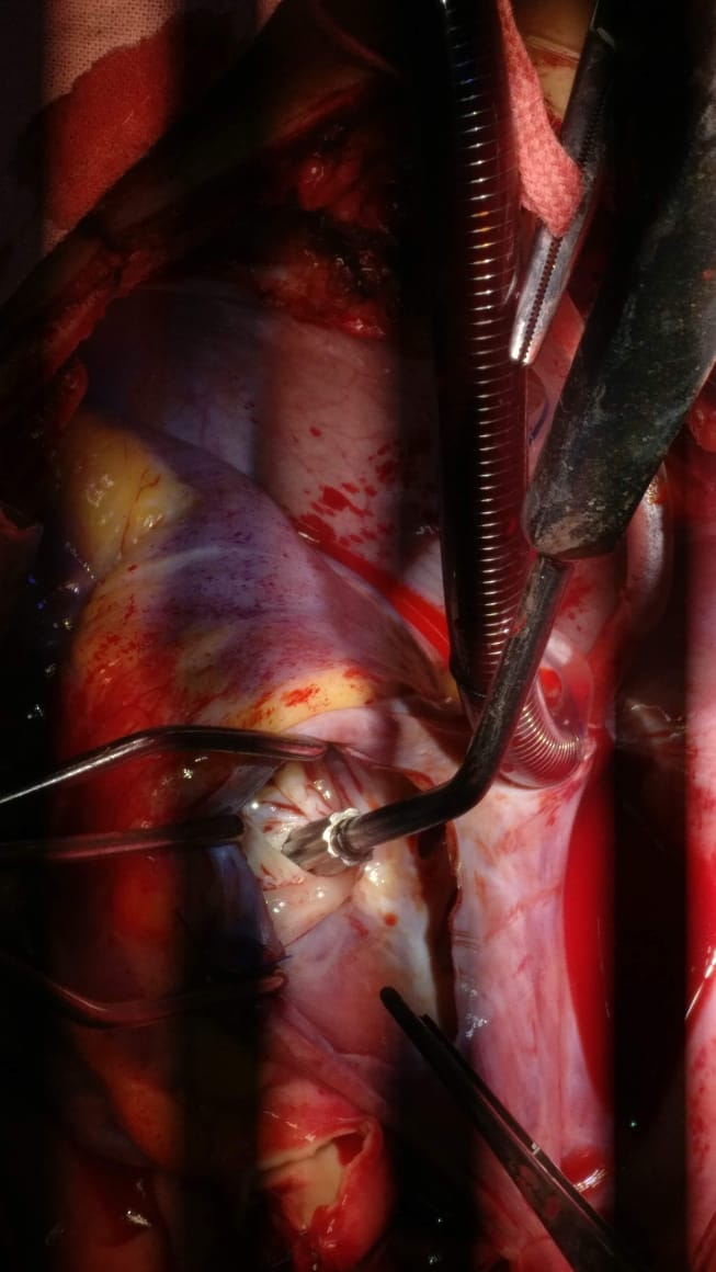 Unique Surgical Procedures surgical photo