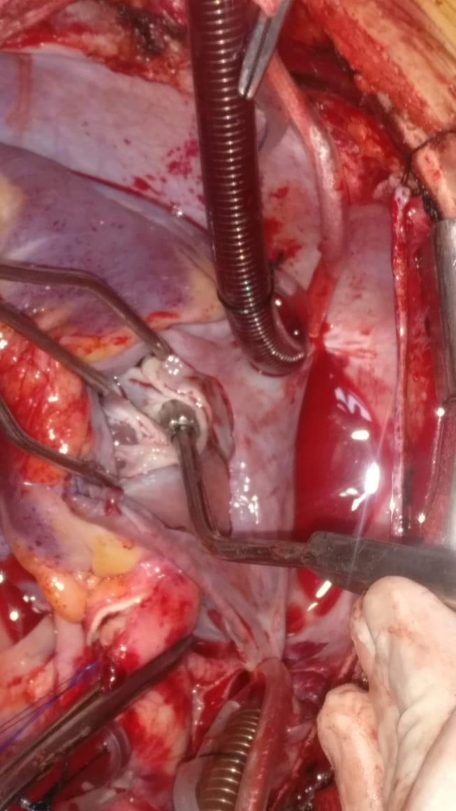 Unique Surgical Procedures surgical photo