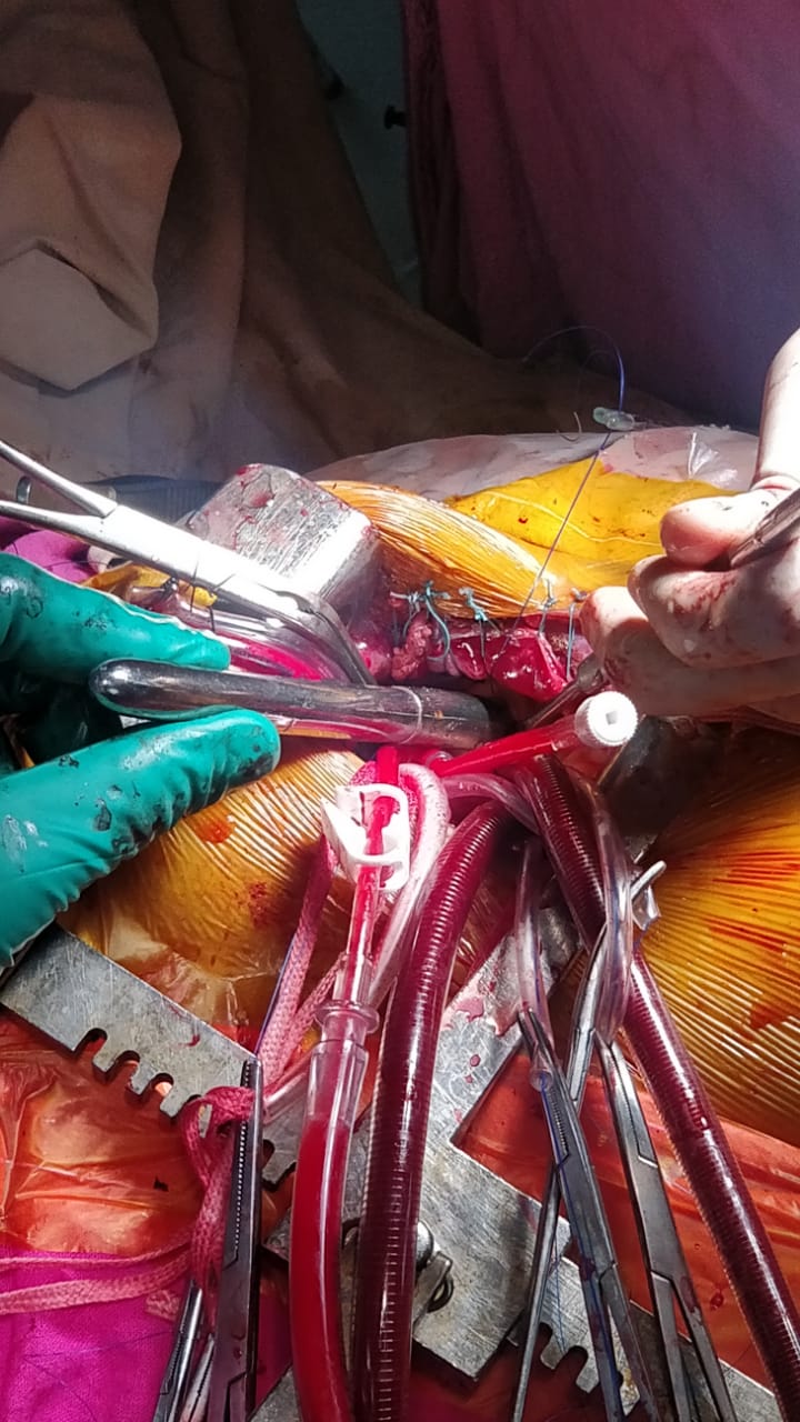 Unique Surgical Procedures surgical photo