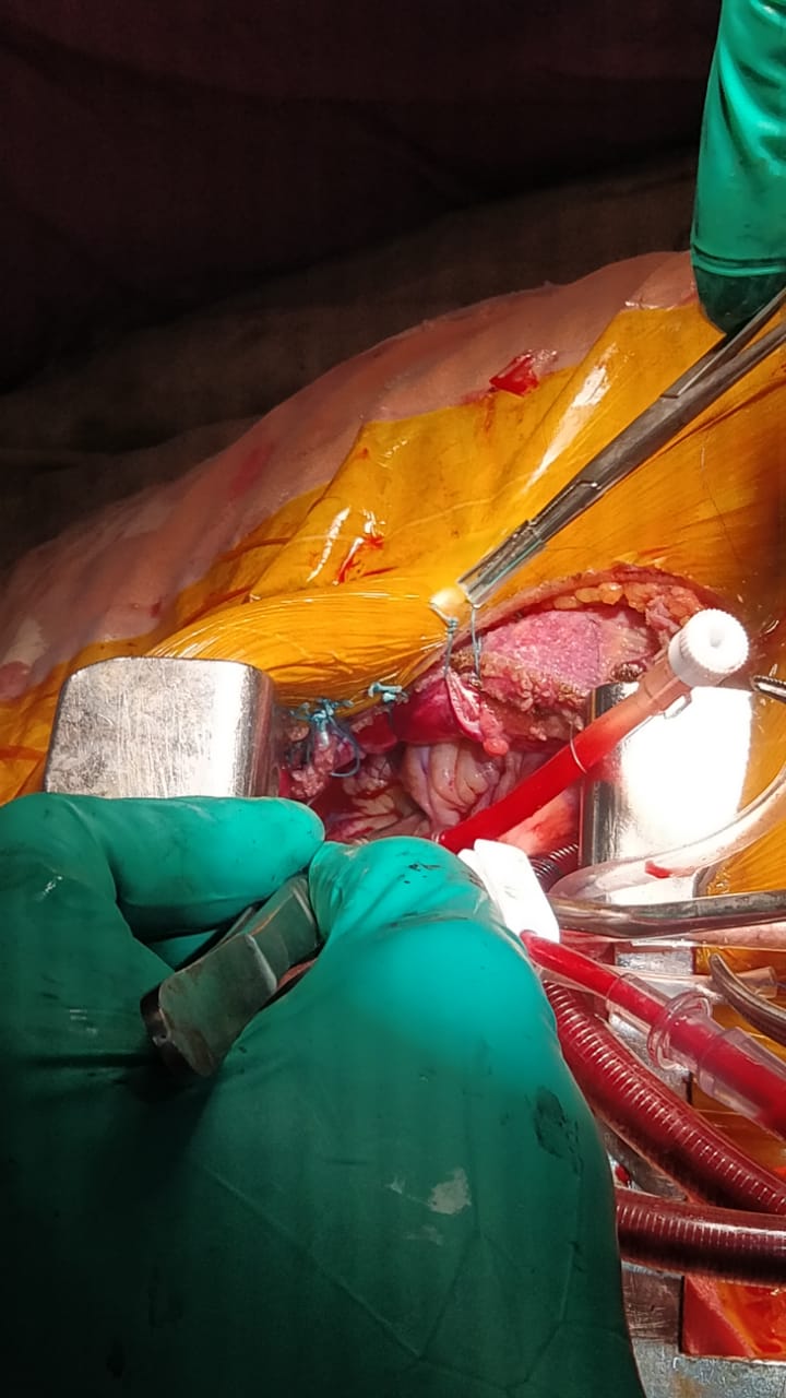 Unique Surgical Procedures surgical photo