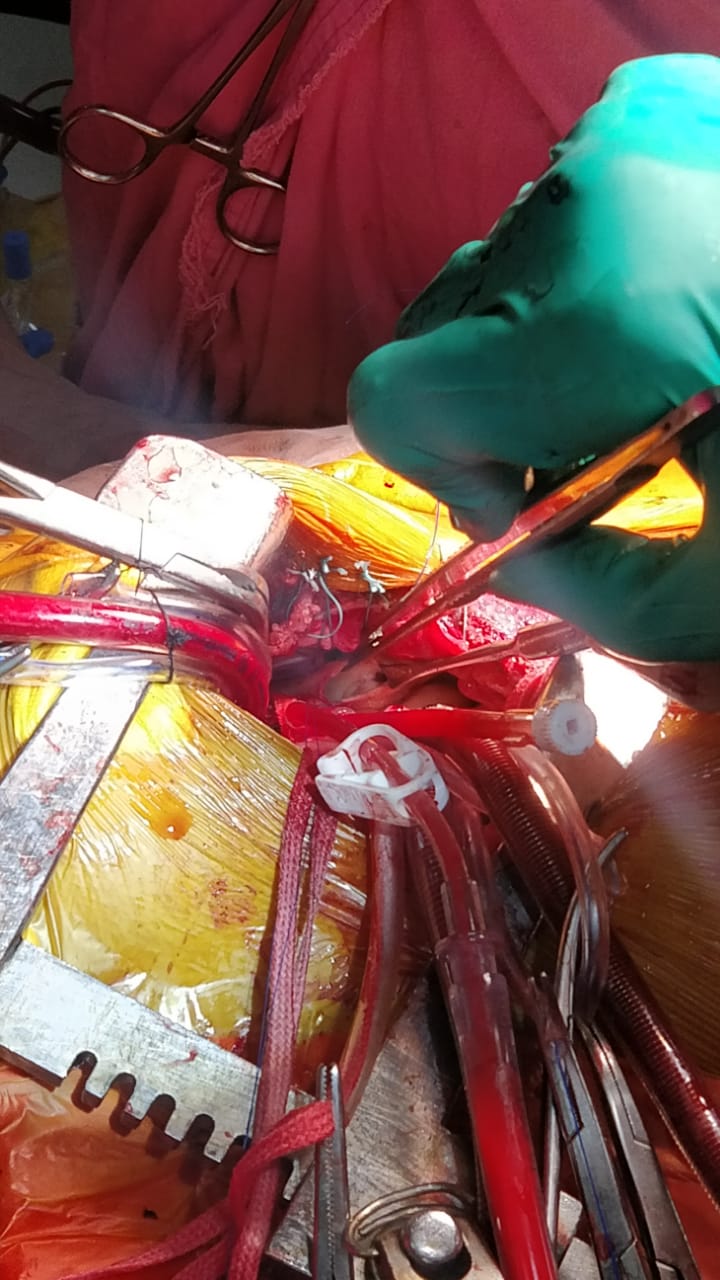 Unique Surgical Procedures surgical photo