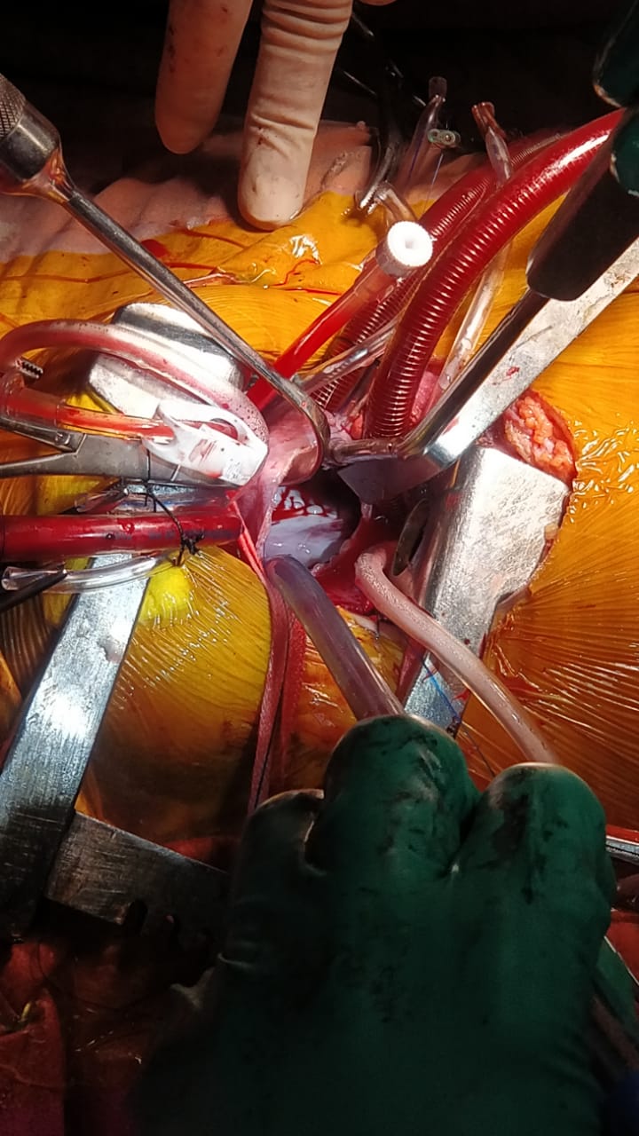 Unique Surgical Procedures surgical photo