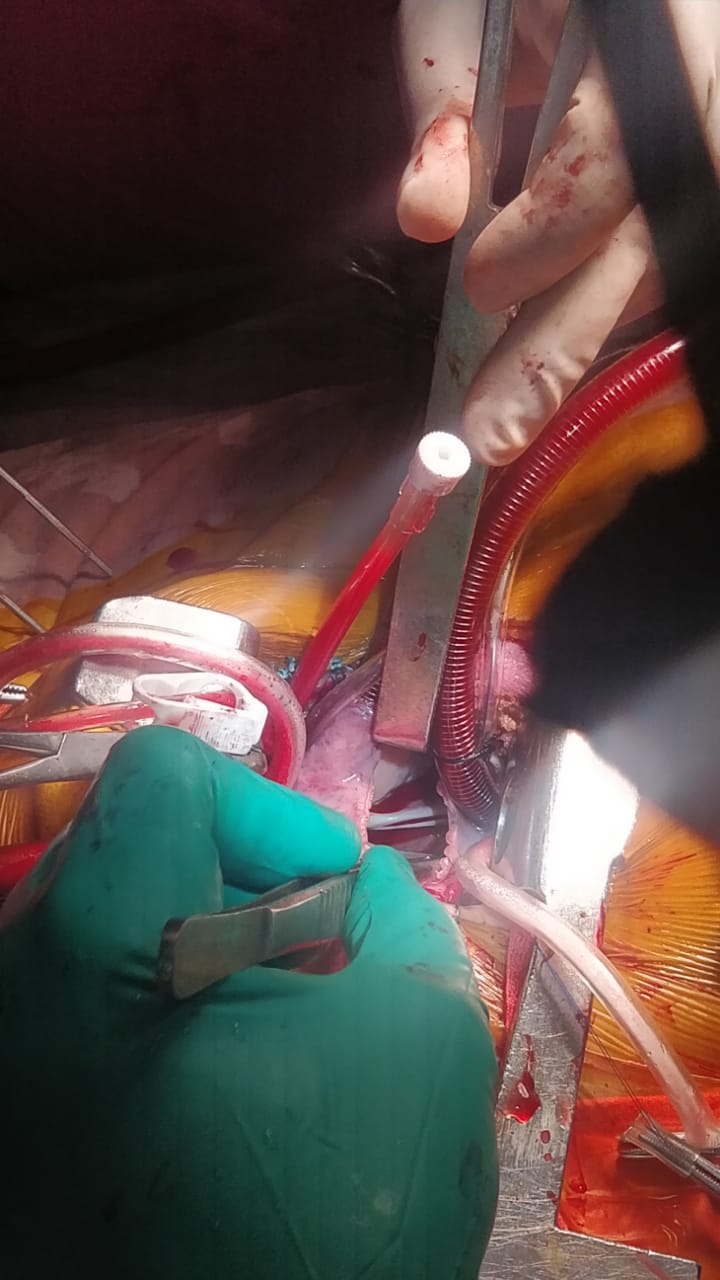 Unique Surgical Procedures surgical photo